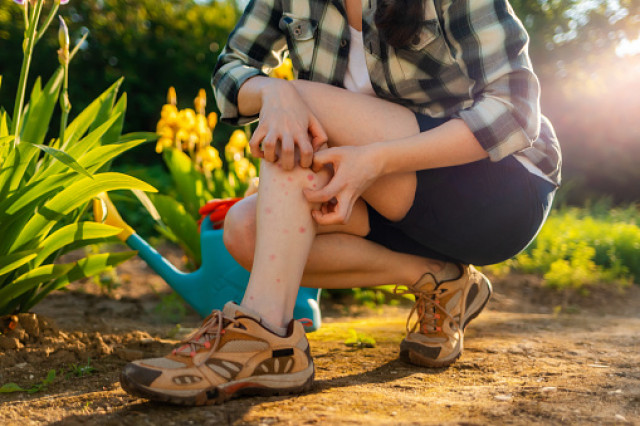 Mosquito Prevention Tips And Tricks